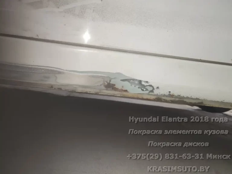 Elantra 20018 - 18