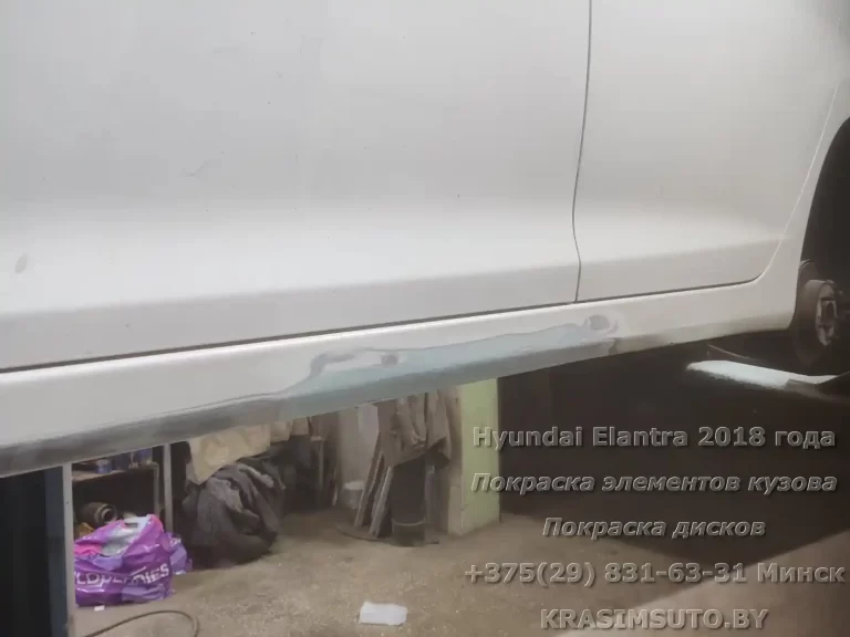 Elantra 20018 - 49