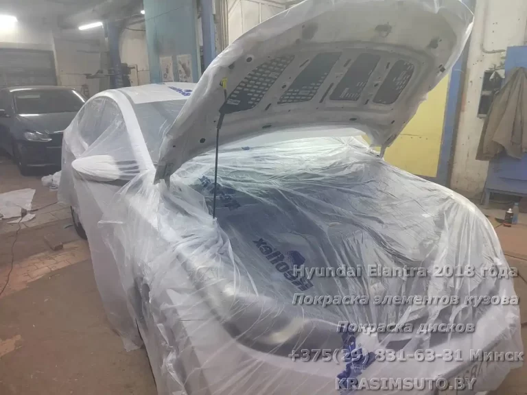 Elantra 20018 - 5