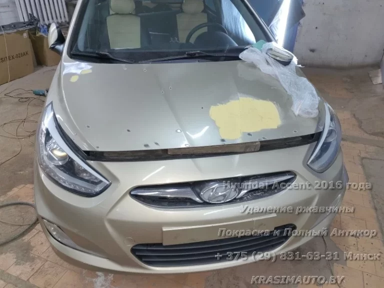 Hyundai Accent 2016 - 11