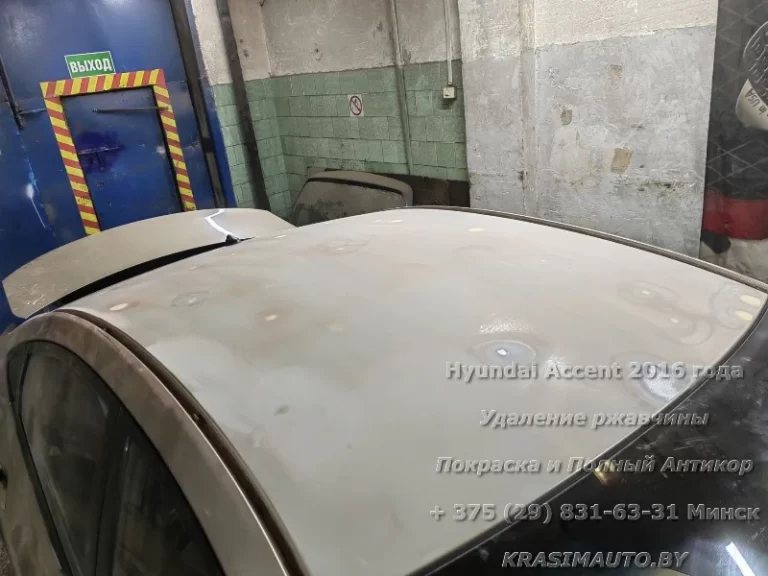 Hyundai Accent 2016 - 5