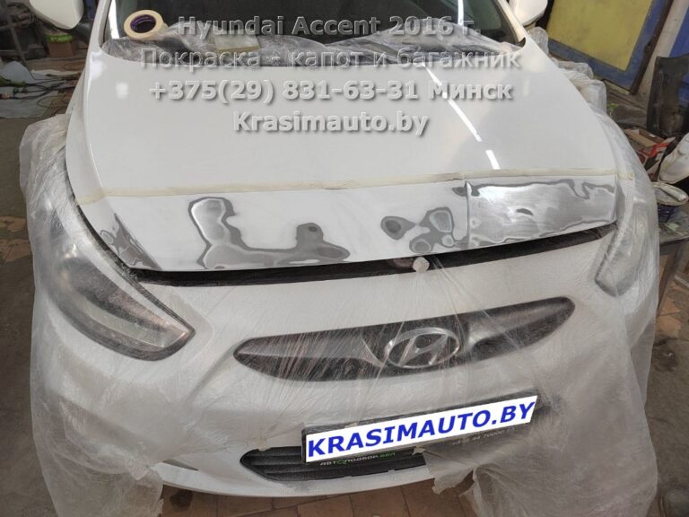 Hyundai Accent 2016