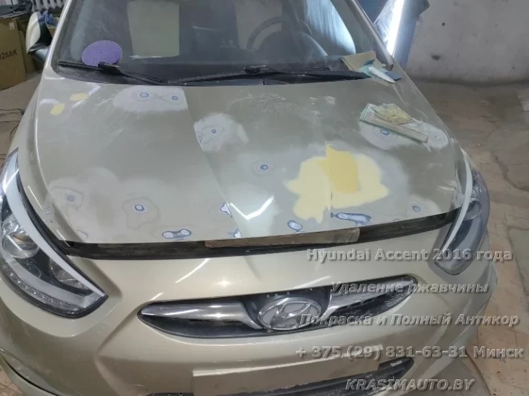 Hyundai Accent 2016 - 9